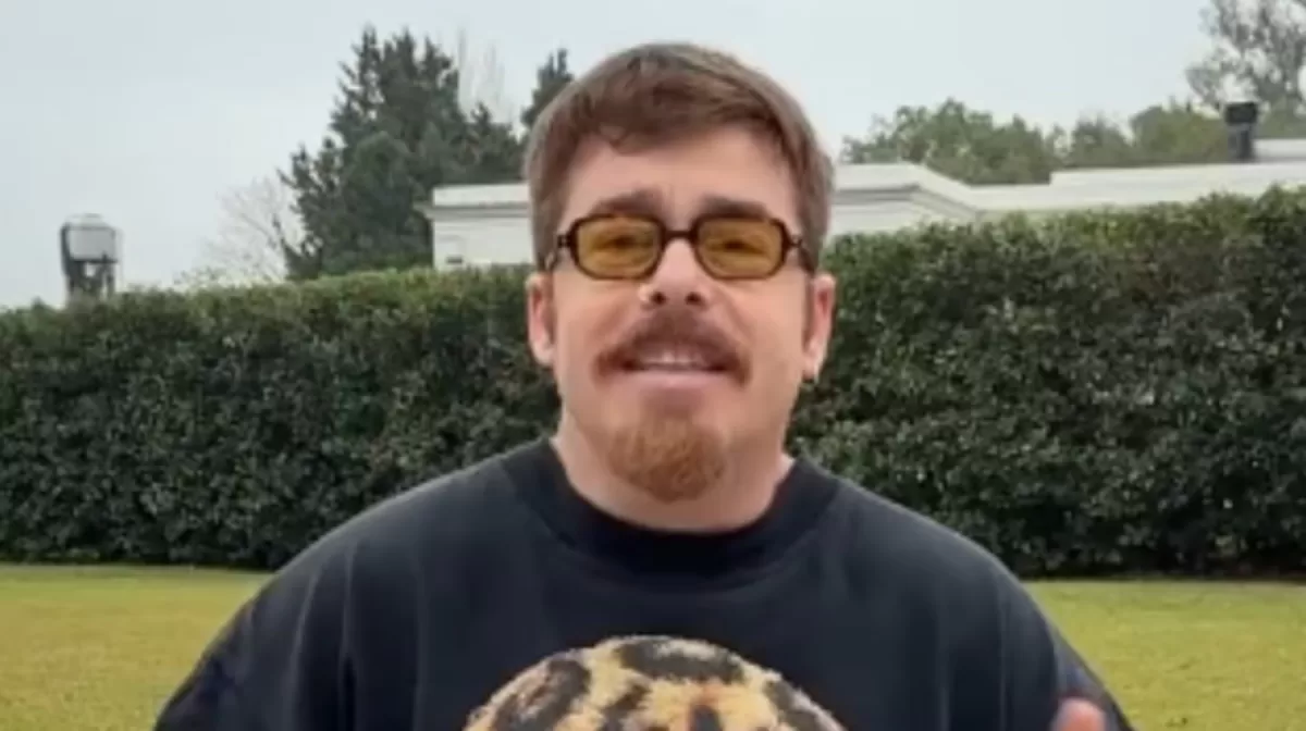 Migue Granados se hizo un implante capilar