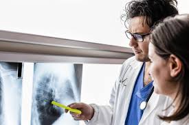 Ya está en Argentina la primera inmunoterapia para el cáncer de pulmón