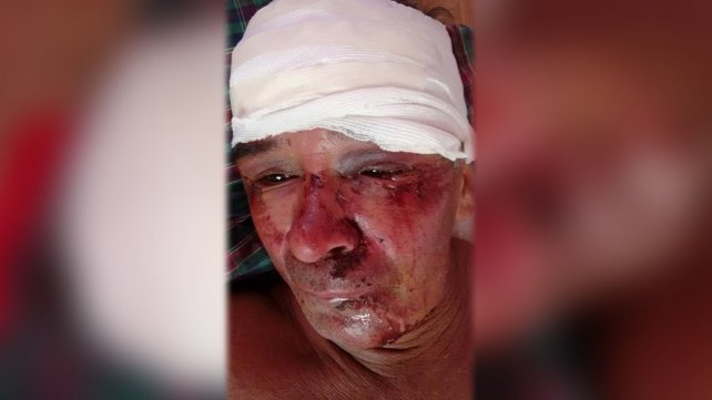 Brutal ataque a un hombre 