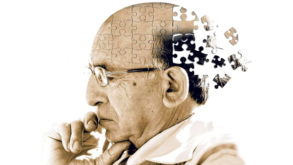 Científicos estudian nuevos test para anticipar el Alzheimer