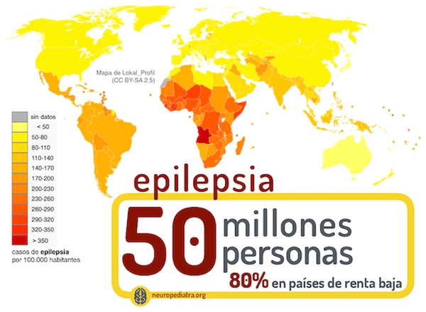 Avances en epilepsia: lanzan un nuevo tratamiento de una sola toma oral