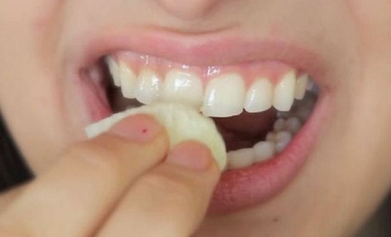 Cómo blanquear los dientes: consejos y falsos mitos