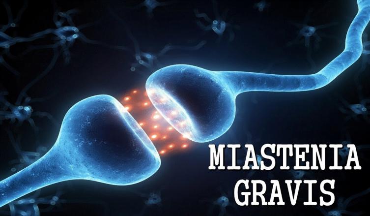 Miastenia Gravis – causas, síntomas y tratamiento