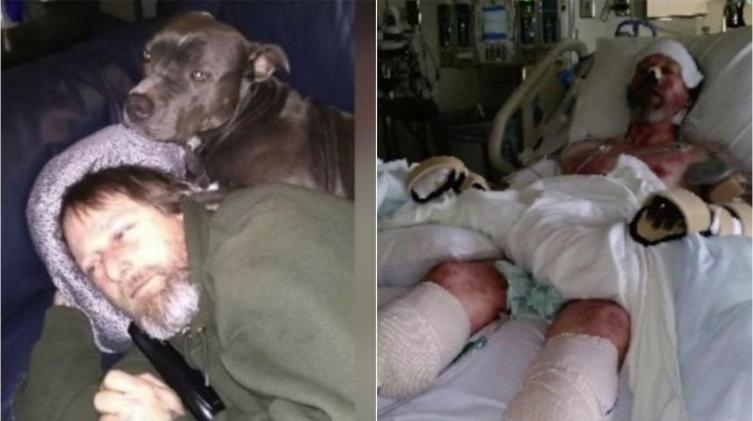 Estados Unidos: por los besos de su perro, le apuntaron las piernas y las manos