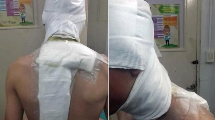 Le tiraron agua hirviendo a un jugador y sufrió graves quemaduras