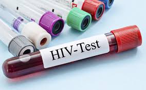 Día Mundial de la Lucha contra el SIDA: los datos del síndrome en la Argentina