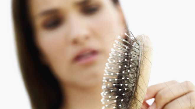 ¿Caída del pelo? ¡Te decimos como superarlo!