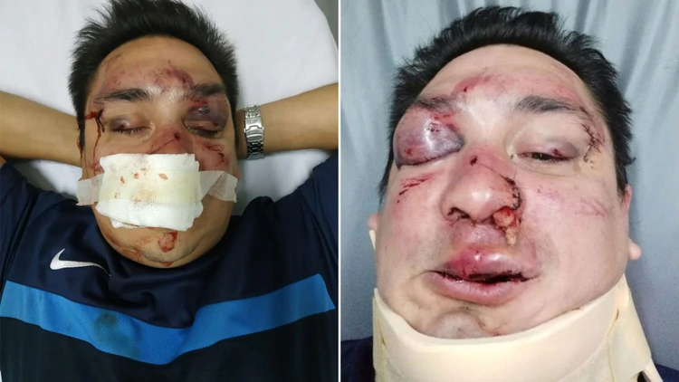 Salvaje agresión de tres barras de Racing a un periodista partidario