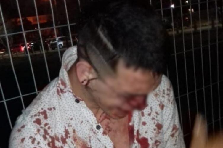 Habló el papá del joven agredido por un patovica