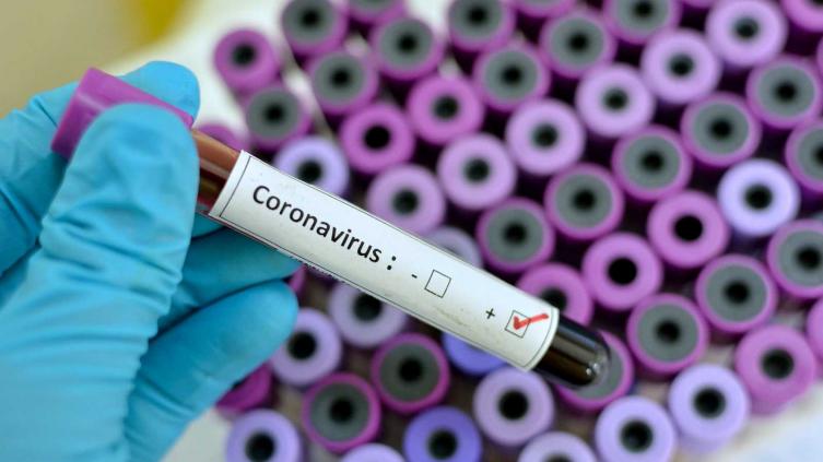 Detectan dos nuevos casos y ya suman 19 en todo el país
