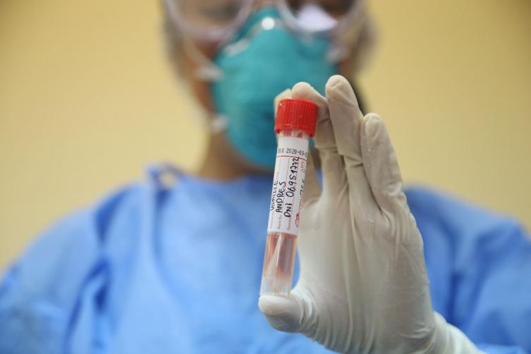 Reportaron 36 nuevos casos de coronavirus y suman 301 los afectados en Argentina
