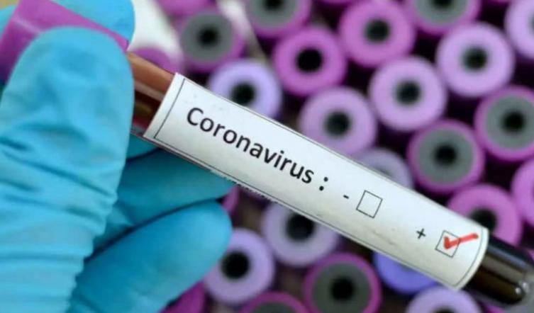 COVID-19: Hay 132 nuevos casos en el país, 1.265 en total y 36 muertes
