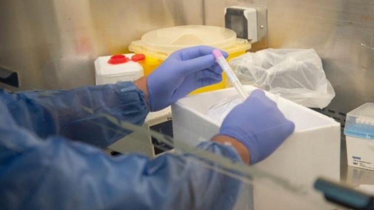 Ya hay 82 muertos por coronavirus en Argentina y 1.975 infectados