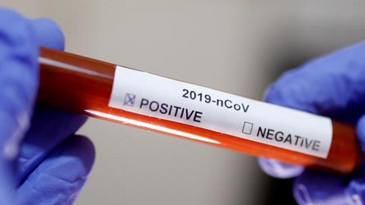 Dos nuevos casos de coronavirus en Santa Fe 