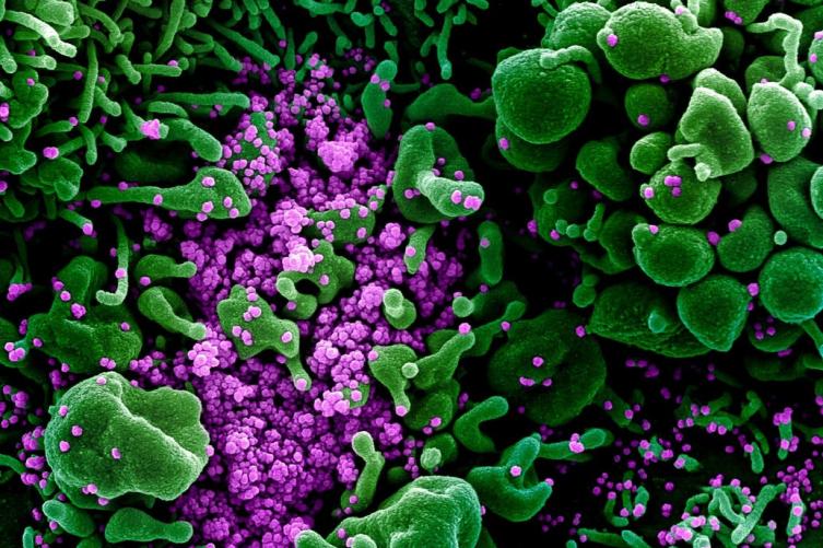 La vacuna contra el coronavirus podría estar lista para septiembre