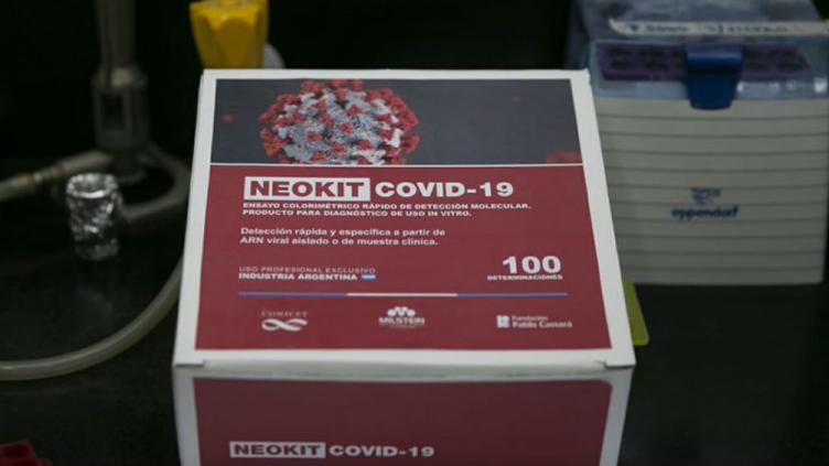 Cómo son los test de diagnóstico rápido que aprobó la Anmat