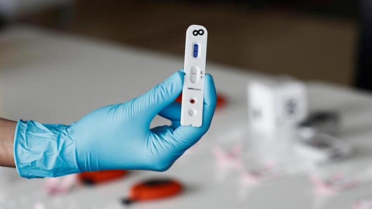 Nuevo récord de contagios en el país: 438 casos en un día
