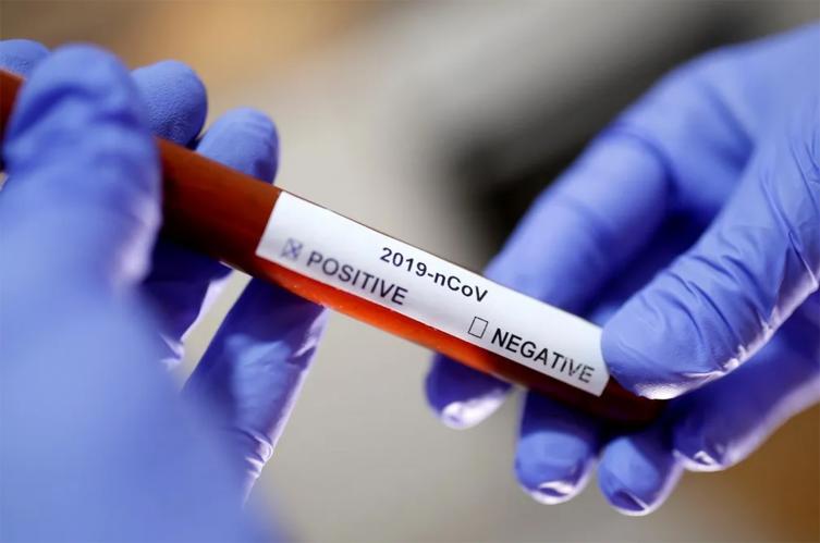 Por la pandemia hubo más de 400.000 muertes en todo el mundo