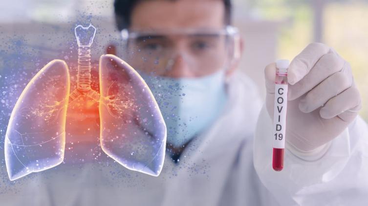 Coronavirus: Cinco nuevos casos en Santa Fe