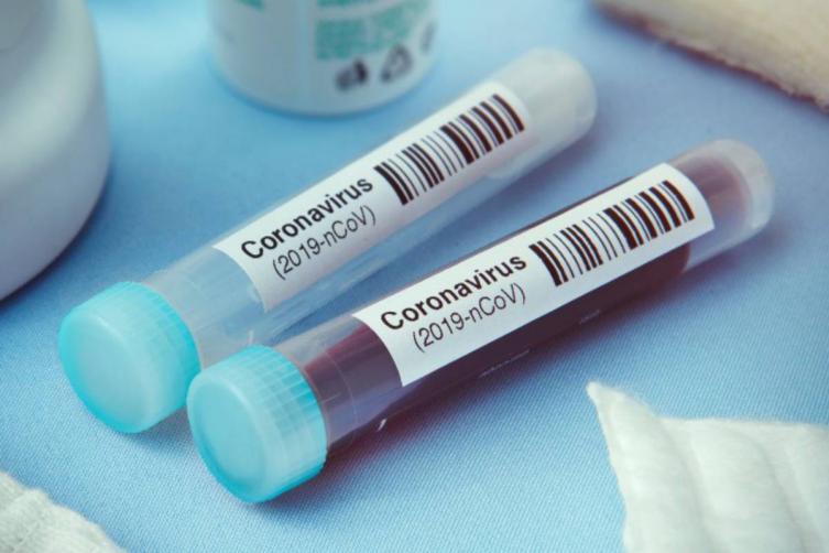 Coronavirus: 33 nuevos casos en Santa Fe
