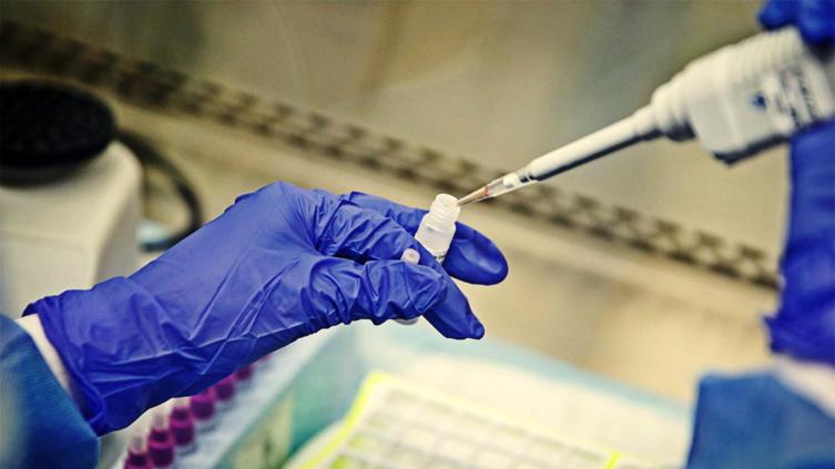 Santa Fe: Falleció un joven de 18 años de coronavirus 
