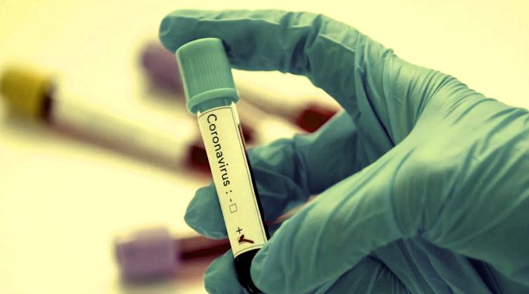 Tres nuevos fallecidos por coronavirus en Santa Fe