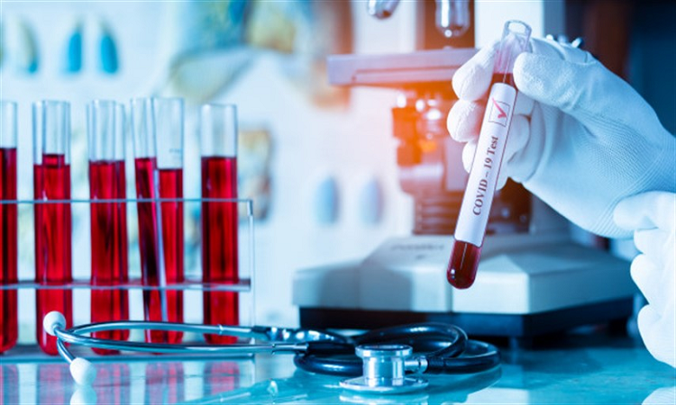 295 casos positivos de coronavirus se suman en la provincia, con 11 en la ciudad de Santa Fe