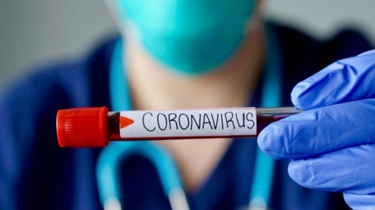 713 nuevos casos de Covid en la provincia, 71 en la ciudad capital
