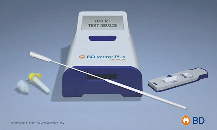 Cómo es el test aprobado por la ANMAT que permite diagnosticar COVID-19 en sólo 15 minutos