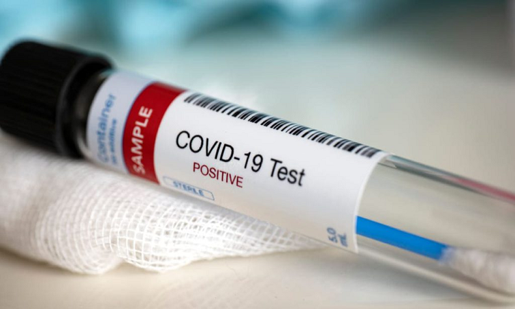 Coronavirus: Santa Fe informa 39 casos de los 377 que hubo en toda la provincia, 14 fallecidos