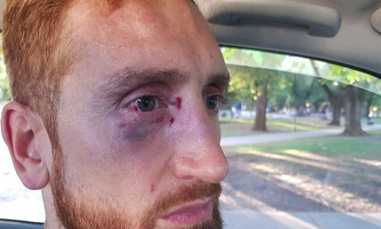 Liga Nacional de Básquet: Reinick, de Quilmes, agredido por hinchas de Peñarol