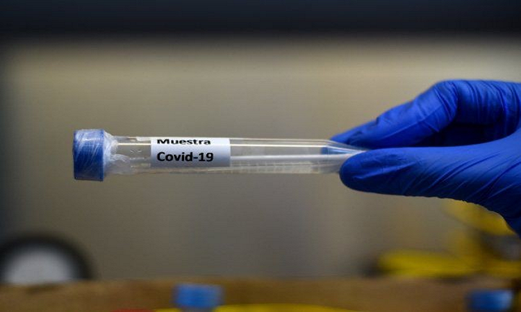 Covid-19: 464 nuevos casos en la provincia y 35 en la ciudad de Santa Fe