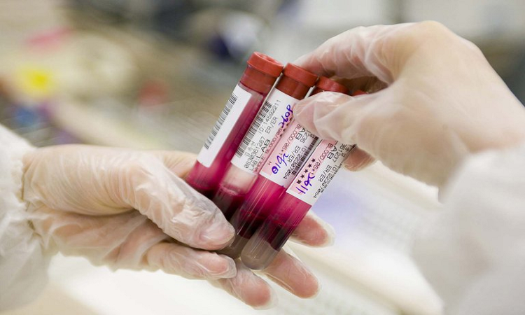 Científicos israelíes desarrollaron un tratamiento para curar un tipo de cáncer
