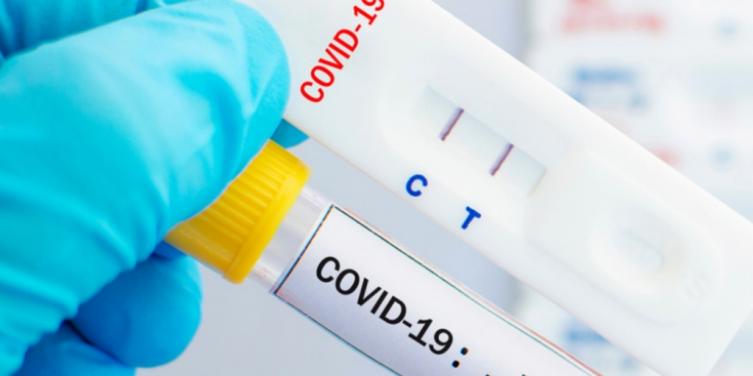 El Gobierno compró 400 mil test de antígenos para detectar COVID