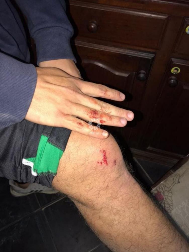 Incidentes en el partido entre El Cadi y Don Salvador