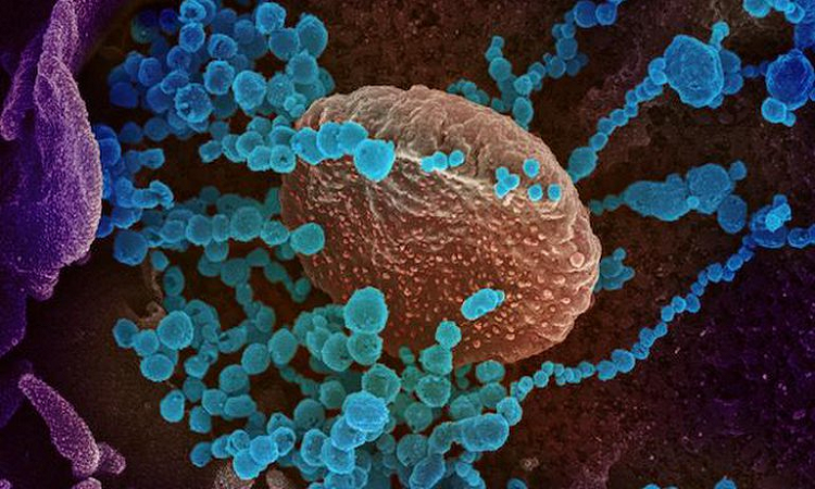 COVID-19: detectan el primer caso de síndrome anal inquieto