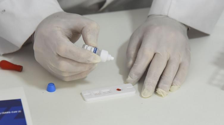 La provincia adhirió al procedimiento para el reporte de uso y la notificación del resultado de los autotest