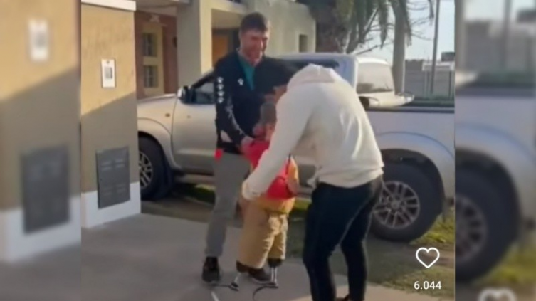 Un niño con amputación congénita y el 