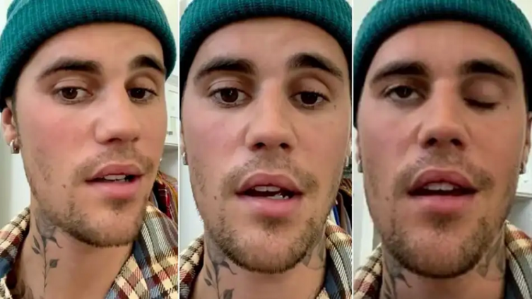 Justin Bieber sufre una parálisis facial por un raro trastorno