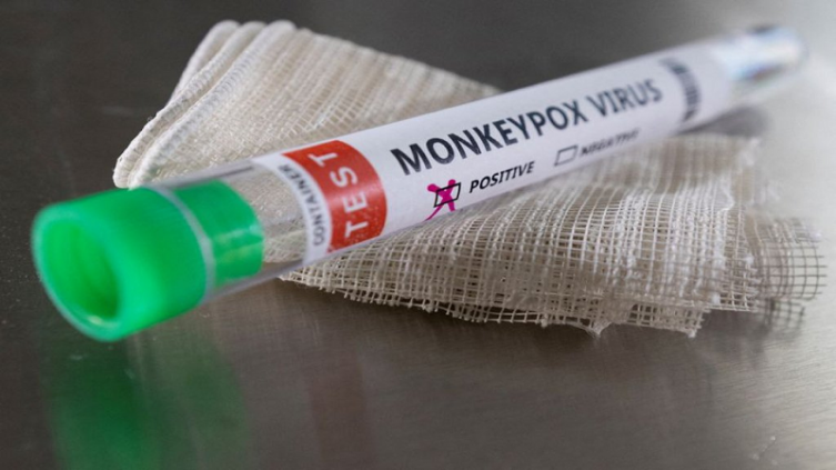 Viruela del mono: Chile declaró alerta sanitaria 