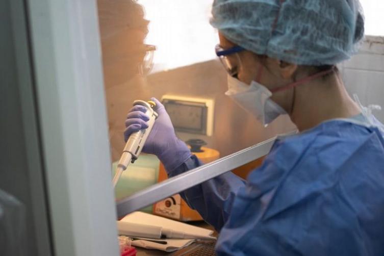 Confirman la segunda muerte por viruela símica en Argentina