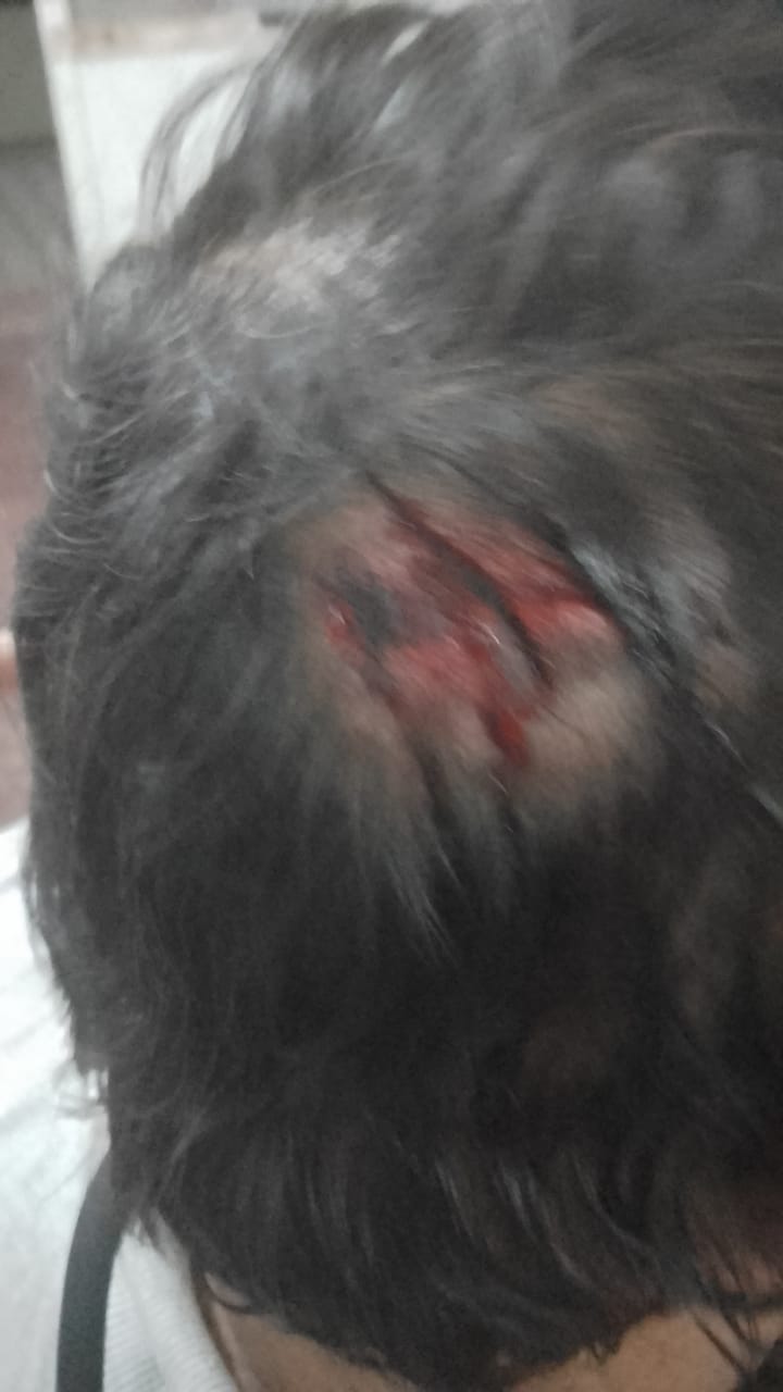 Un inspector fue agredido con un fierro en la cabeza en un operativo