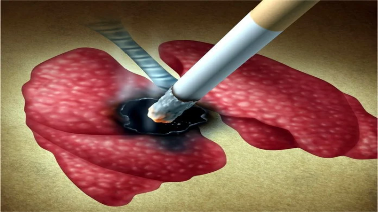 Tus pulmones pueden recuperarse del daño hecho por el tabaquismo 