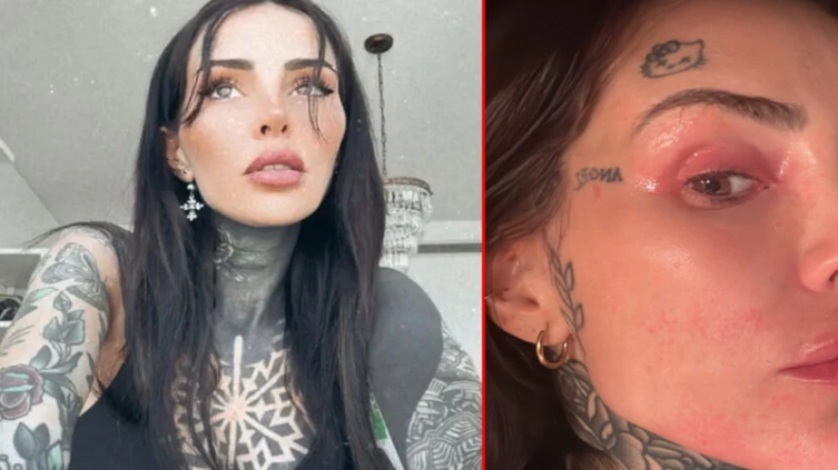 Cande Tinelli sufre un problema de salud y pide ayuda