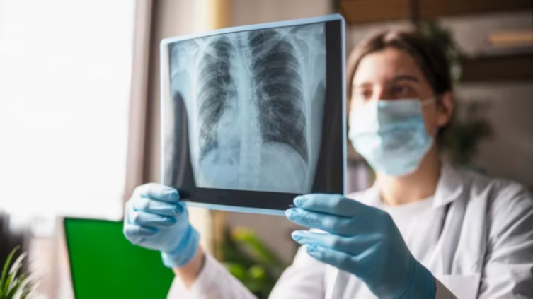 Enfermedades respiratorias: la pandemia alteró el calendario., sus riesgos