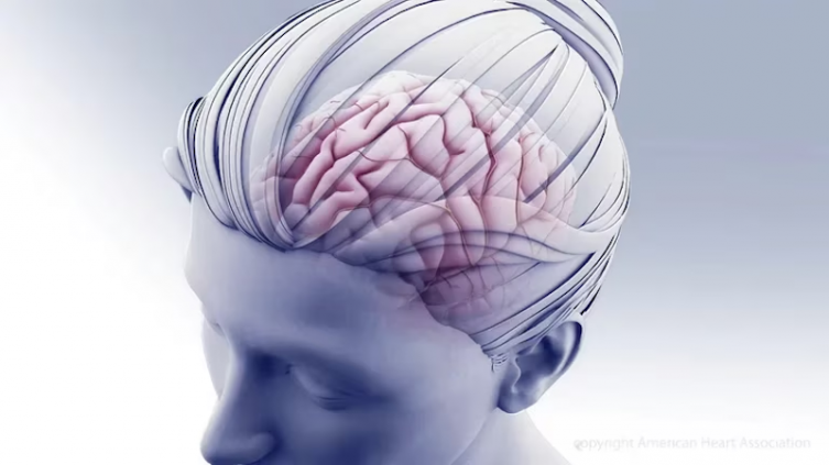 Día Mundial de la Migraña: consejos para aliviar los síntomas