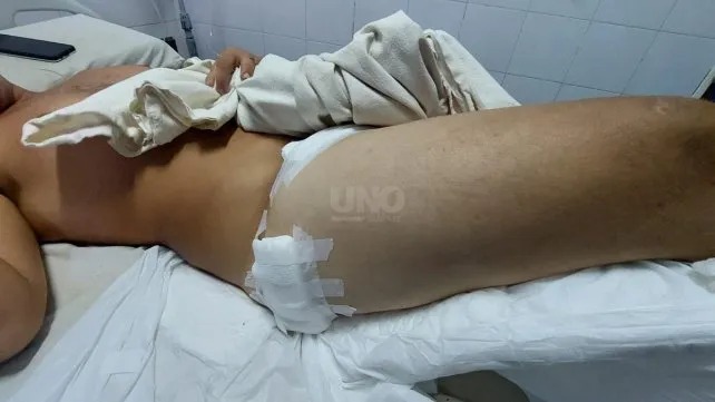 Ataque sicario en barrio Centenario: 