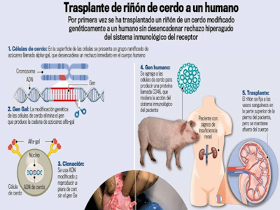 El primer trasplante a humano de riñón de cerdo modificado genéticamente