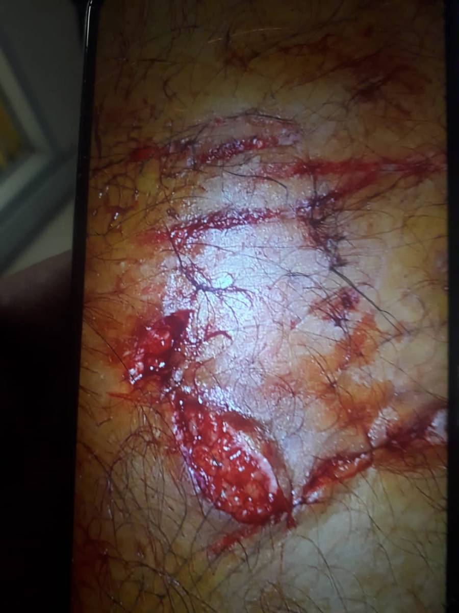 Se recupera el policía atacado por un pitbull cuando fue a requisar una casa 