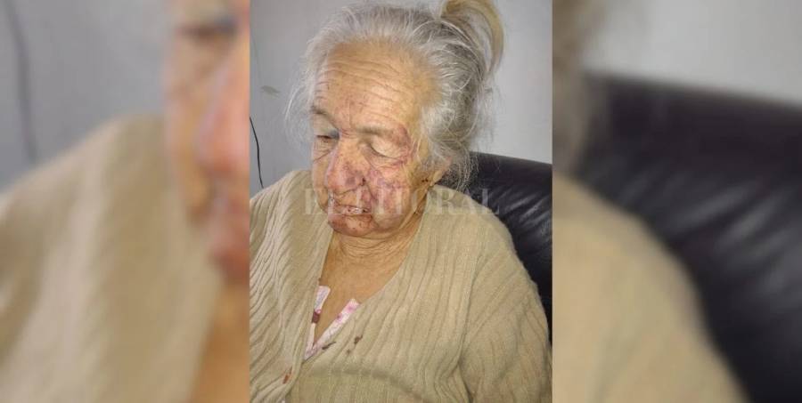 Salvaje asalto sufrió una jubilada en su vivienda de barrio Cabal
